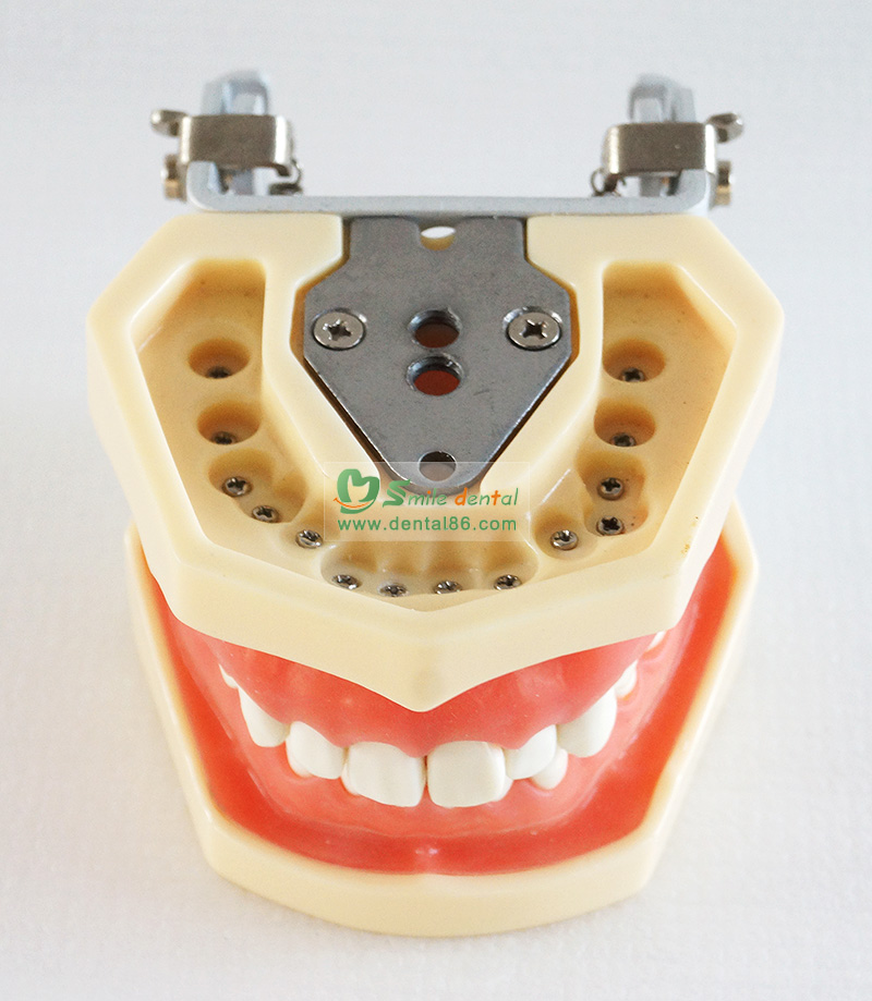 A14 Standard Model